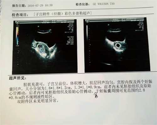 深圳哪有代孕的_深圳正规医院可以做代孕吗_1617686795797