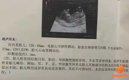 广州传承生殖中心怎么样[哪里有供卵试管]+南开姐妹41岁大龄子宫环境不好还可