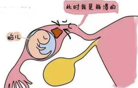 孕期吃韭菜饺子的危害